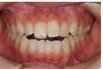 %e9%96%8b%e5%92%ac%e3%80%80%ef%bc%91